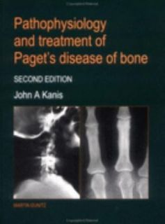 Pathophysiology and Treatment of Pagets Disease of Bone by J. A 