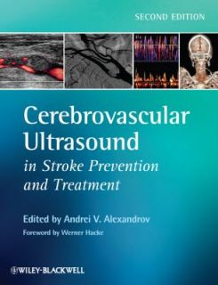 Cerebrovascular Ultrasound in Stroke Prevention and Treatment by 