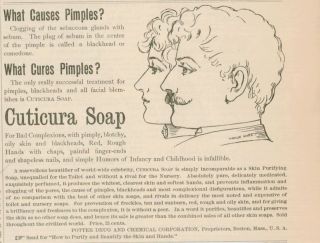 1890 Ad Potter Drug Boston Cuticura Soap Cures Pimples