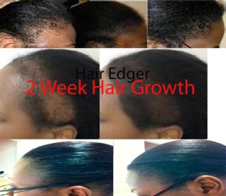  Jamaican Black Castor Oil Extream Hair Growth 