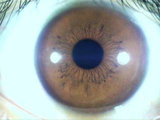 0M Iriscope/Iridology eye(Support hai/skin lens) with software